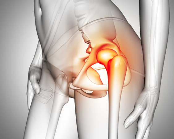 Dr. Brian Capogna Offers Valuable Insights For People To Avoid Hip Pain