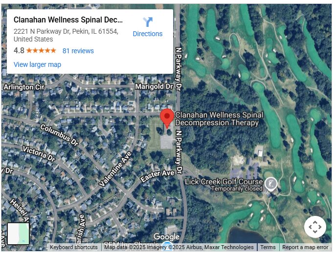 Clanahan Wellness Spinal Decompression Therapy
