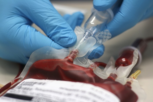 NYC Attorney Offers Insight on Blood Transfusion Mistakes