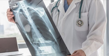 Is lung cancer misdiagnosis medical malpractice?