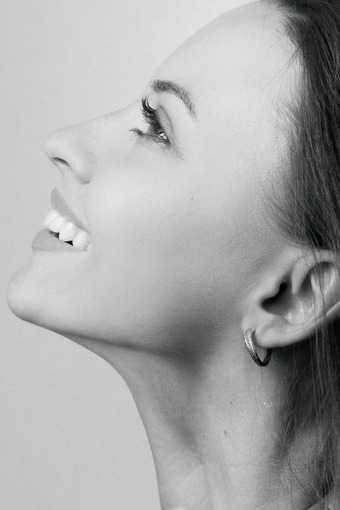 What to Expect Before, During, and After Kybella