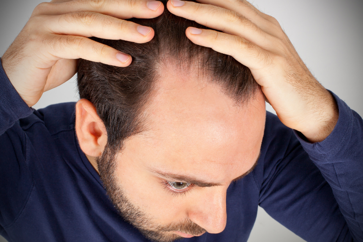 How Do You Know It’s Time to Get a Hair Replacement? Top 3 Signs 