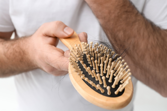 The Link Between Stress and Hair Loss — Folicure Hair Replacement Dallas