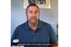 Satisfied Customer Shares Experience On How His Toenail Fungus Disappears After Using Crystal Flush 