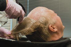 What Exactly Are Folicure Hair Replacement Solutions