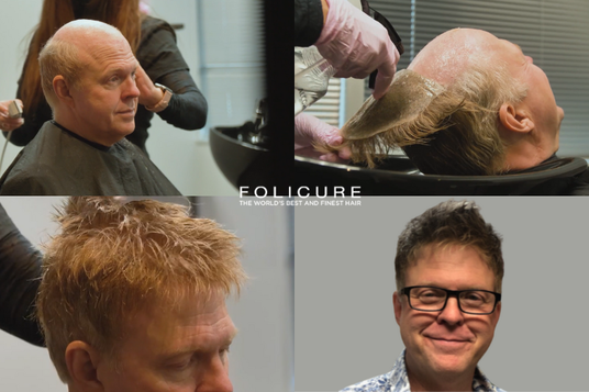 The Top 6 Reasons You Should Switch to Folicure Dallas Hair Replacement Service