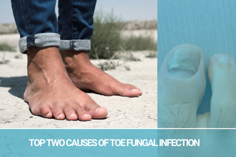 Crystal Flush Anti-Toe Fungal Experts Discuss The Top Two Causes of Toe Fungal Infection
