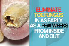 How does Crystal Flush Differ from Other Antifungal Treatments?