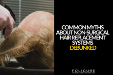 Common Myths About Non-Surgical Hair Replacement Systems Debunked 